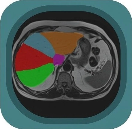 MRI liver lobes and segments  anatomy icon